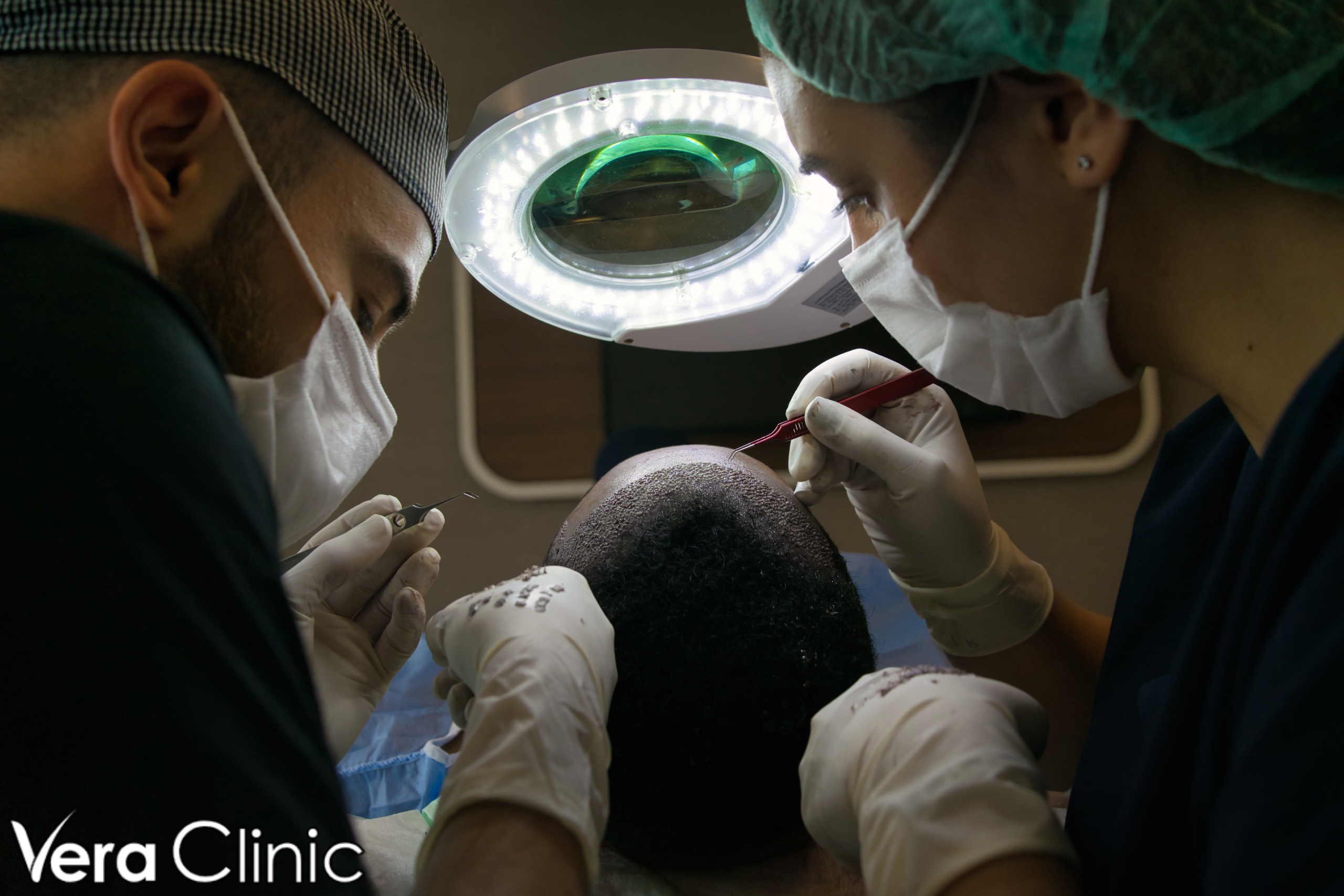 istanbul hair transplant